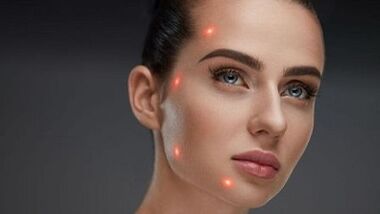 Какво е частично подмладяване на кожата